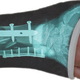 Illustration for article titled Casttoo X-Ray Cast Wraps Replace Pity with Awe